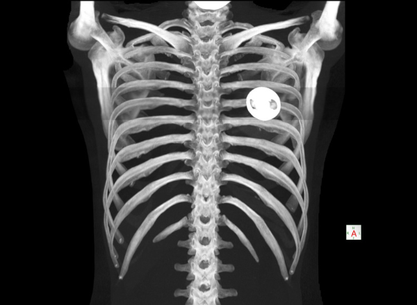 Radiografía de tórax digital en San Juan de Miraflores – diagnóstico rápido