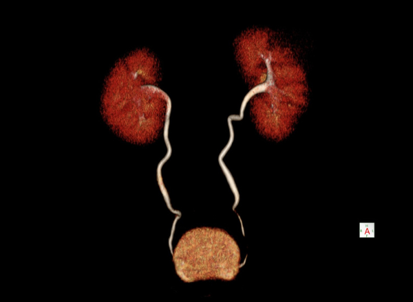 Área de tomografía con contraste – Centro de Imágenes Médicas