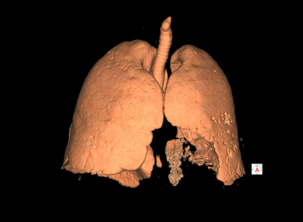 Rayos X digital de miembros inferiores – Clínica en Lima Sur